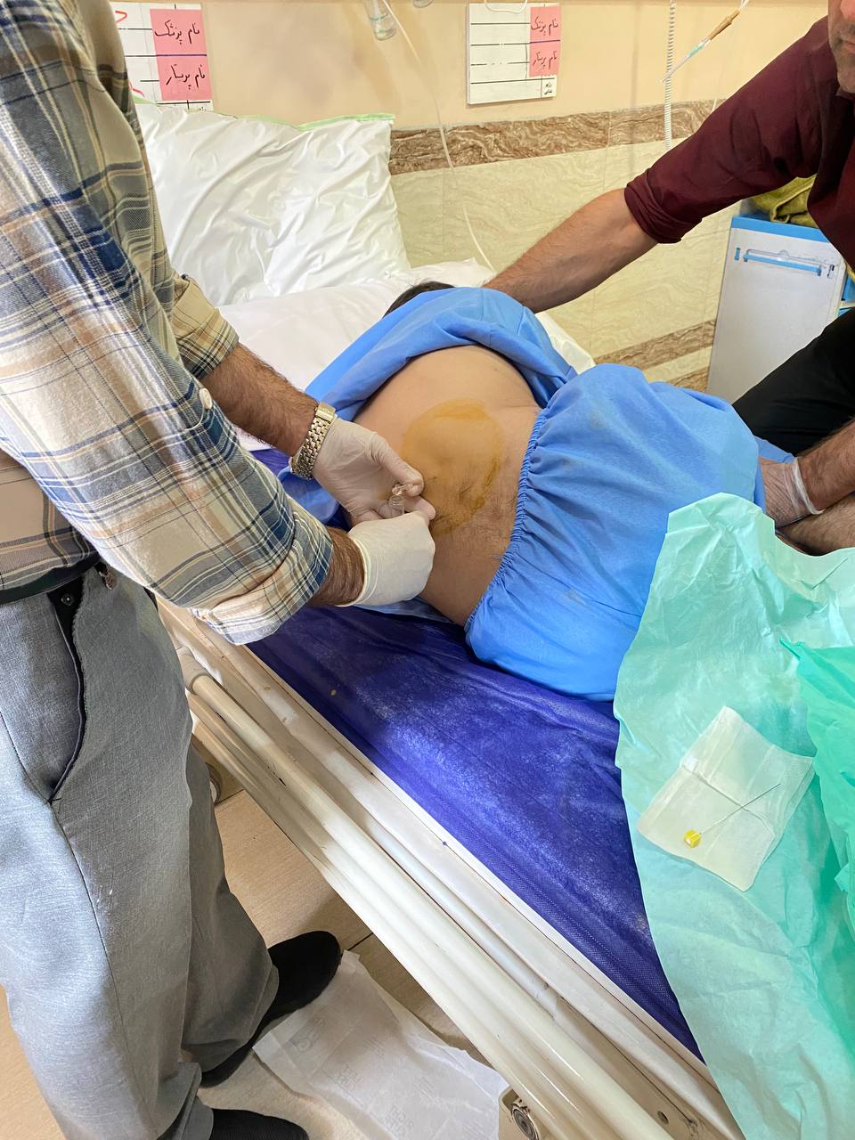 آن روی سکه